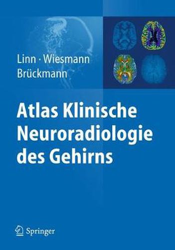 Cover image for Atlas Klinische Neuroradiologie des Gehirns