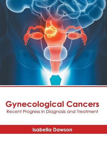 Cover image for Gynecological Cancers: Recent Progress in Diagnosis and Treatment