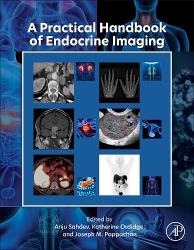 Cover image for A Practical Handbook of Endocrine Imaging