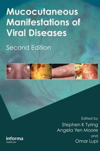 Mucocutaneous Manifestations of Viral Diseases: An Illustrated Guide to Diagnosis and Management