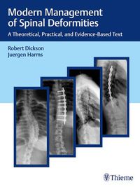 Cover image for Modern Management of Spinal Deformities: A Theoretical, Practical, and Evidence-Based Text