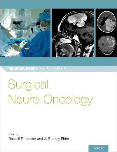 Cover image for Surgical Neuro-Oncology