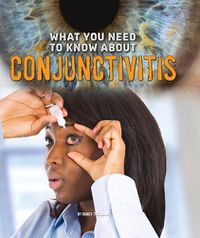 Cover image for What You Need to Know about Conjunctivitis