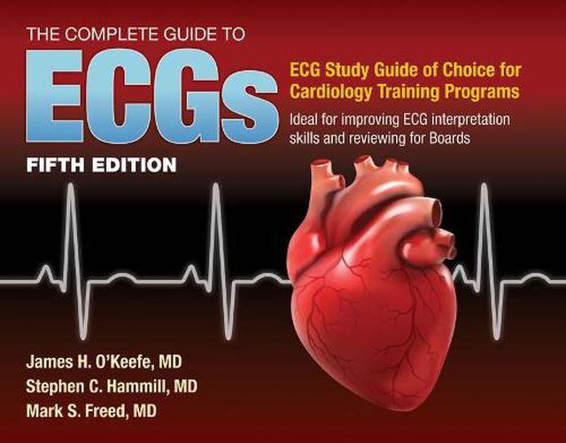 The Complete Guide to ECGs: A Comprehensive Study Guide to Improve ECG Interpretation Skills