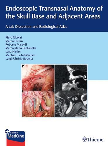 Cover image for Endoscopic Transnasal Anatomy of the Skull Base and Adjacent Areas: A Lab Dissection and Radiological Atlas