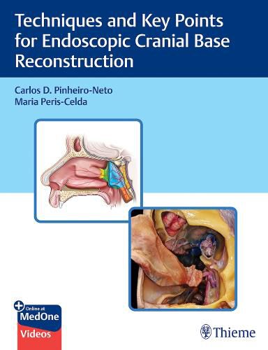 Cover image for Techniques and Key Points for Endoscopic Cranial Base Reconstruction