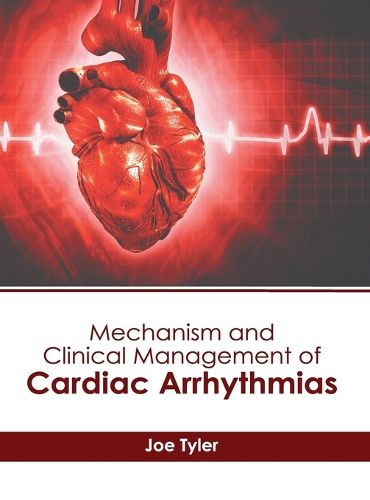 Cover image for Mechanism and Clinical Management of Cardiac Arrhythmias