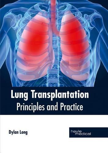 Cover image for Lung Transplantation: Principles and Practice