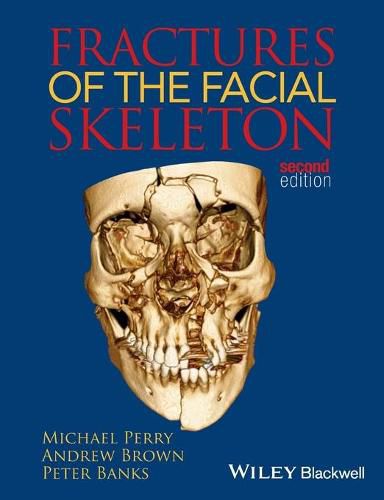 Fractures of the Facial Skeleton