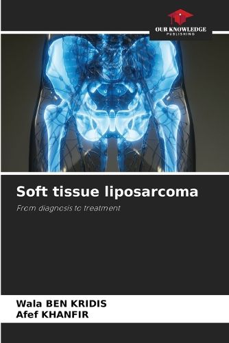 Cover image for Soft tissue liposarcoma