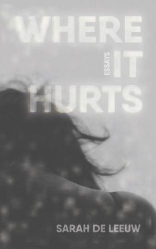 Cover image for Where It Hurts