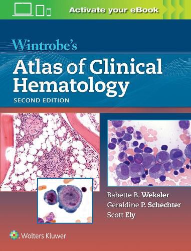 Cover image for Wintrobe's Atlas of Clinical Hematology