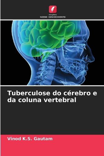 Cover image for Tuberculose do cerebro e da coluna vertebral