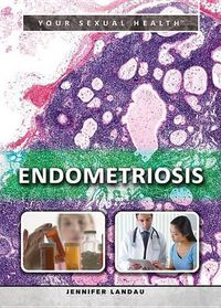 Cover image for Endometriosis