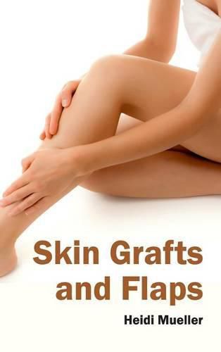 Cover image for Skin Grafts and Flaps