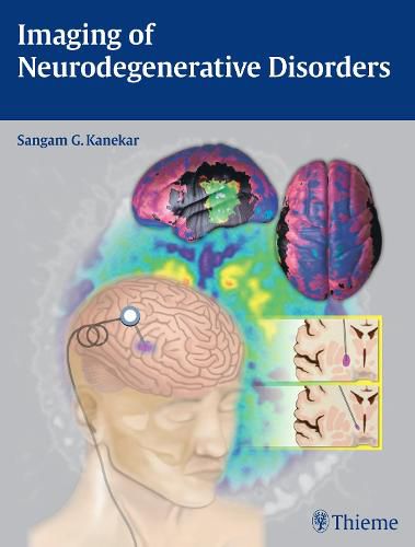 Cover image for Imaging of Neurodegenerative Disorders