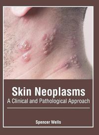 Cover image for Skin Neoplasms: A Clinical and Pathological Approach