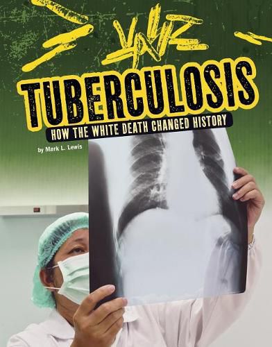 Cover image for Tuberculosis