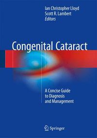 Cover image for Congenital Cataract: A Concise Guide to Diagnosis and Management