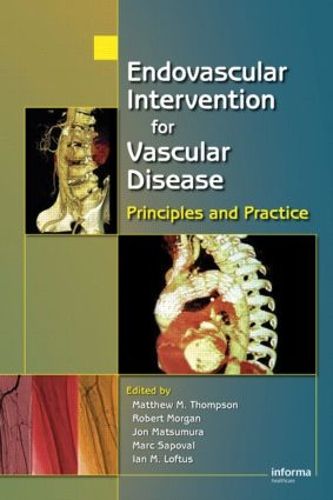 Cover image for Endovascular Intervention for Vascular Disease: Principles and Practice