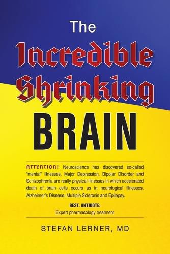 The Incredible Shrinking Brain