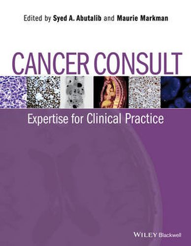 Cover image for Cancer Consult: Expertise for Clinical Practice