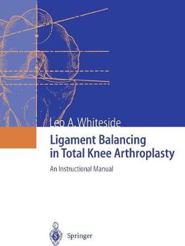 Cover image for Ligament Balancing in Total Knee Arthroplasty: An Instructional Manual