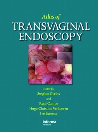 Cover image for Atlas of Transvaginal Endoscopy