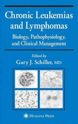 Chronic Leukemias and Lymphomas: Biology, Pathophysiology, and Clinical Management