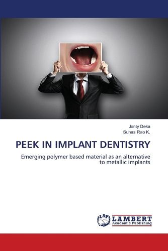 Cover image for Peek in Implant Dentistry