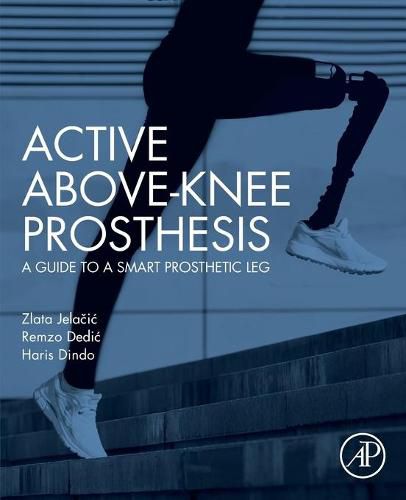 Cover image for Active Above-Knee Prosthesis: A Guide to a Smart Prosthetic Leg