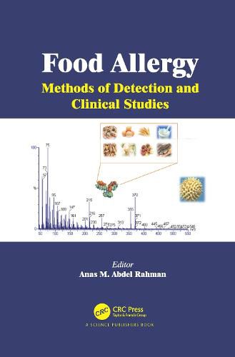 Cover image for Food Allergy: Methods of Detection and Clinical Studies