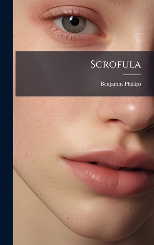 Cover image for Scrofula