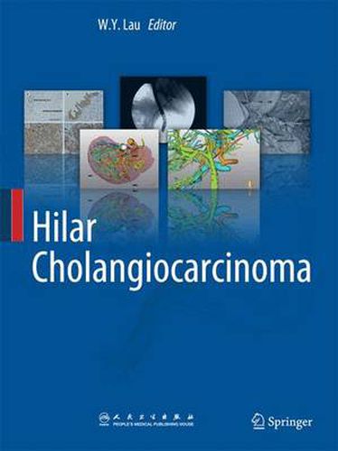 Cover image for Hilar Cholangiocarcinoma