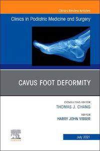Cover image for Cavus Foot Deformity, An Issue of Clinics in Podiatric Medicine and Surgery