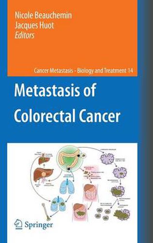 Cover image for Metastasis of Colorectal Cancer