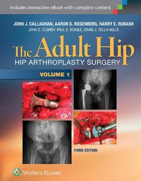 Cover image for The Adult Hip: Arthroplasty and Its Alternatives (2 Vol)