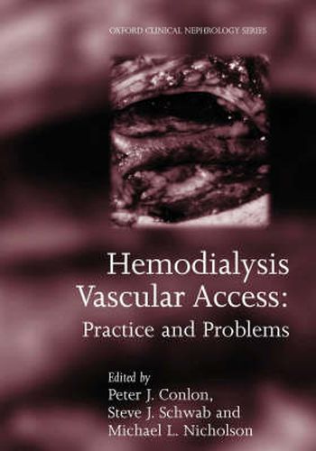 Hemodialysis Vascular Access: Practice and problems