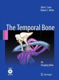 Cover image for Temporal Bone: An Imaging Atlas