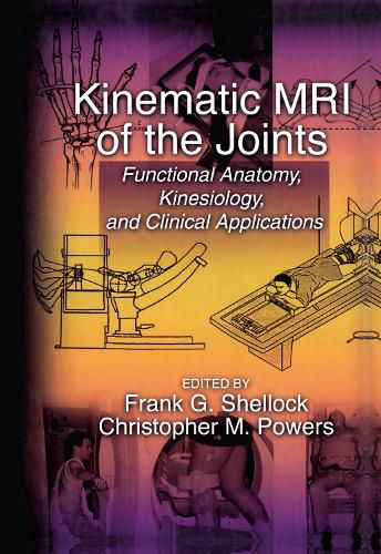 Cover image for Kinematic MRI of the Joints: Functional Anatomy, Kinesiology, and Clinical Applications