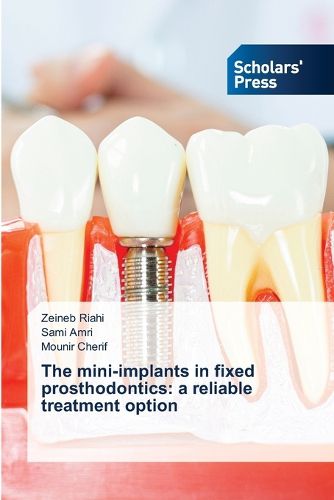 Cover image for The mini-implants in fixed prosthodontics