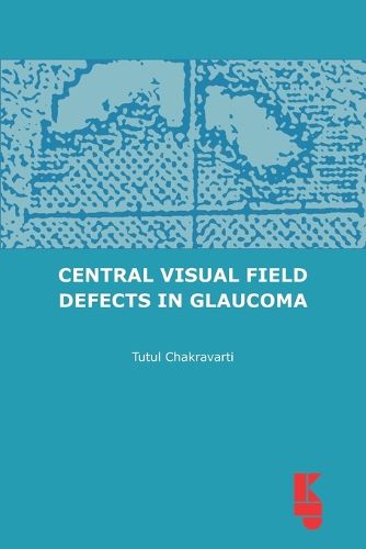 Central Visual Field Defects in Glaucoma, Tutul Chakravarti ...