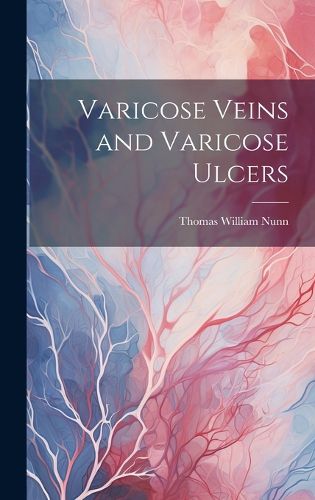 Cover image for Varicose Veins and Varicose Ulcers