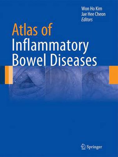 Cover image for Atlas of Inflammatory Bowel Diseases