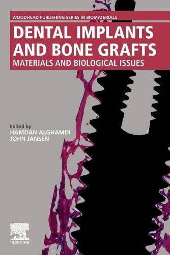 Cover image for Dental Implants and Bone Grafts: Materials and Biological Issues