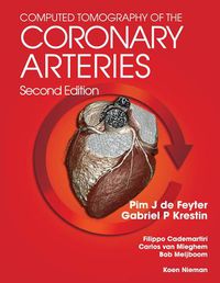 Cover image for Computed Tomography of the Coronary Arteries