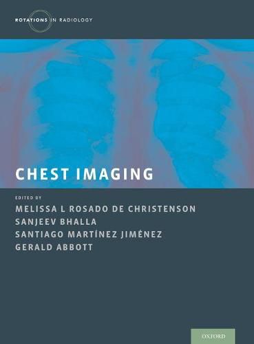 Cover image for Chest Imaging