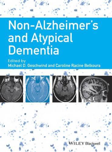 Cover image for Non-Alzheimer's and Atypical Dementia