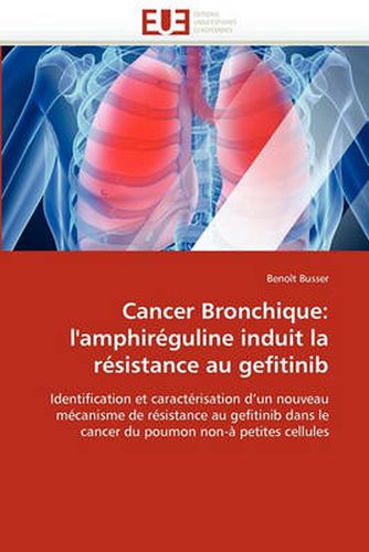 Cover image for Cancer Bronchique: L'Amphireguline Induit La Resistance Au Gefitinib