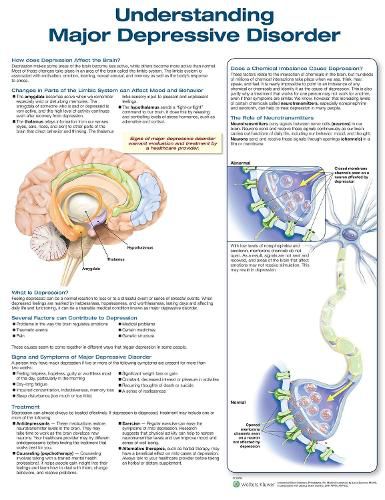 Cover image for Understanding Major Depressive Disorder